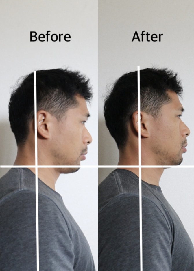 Before After 比較画像
